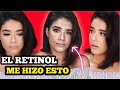 PROBÉ EL RETINOL Y ESTO SUCEDIÓ |USO Y EFECTOS SECUNDARIOS|POR ESTO LO NECESITAS⭐️YISSEL G⭐️