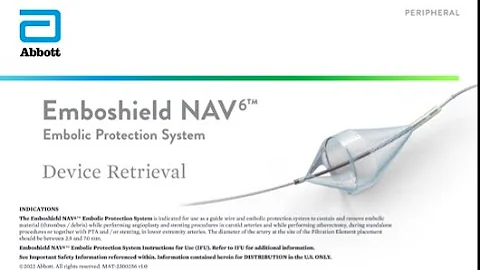 Device Retrieval | Emboshield NAV6™ Embolic Protection System