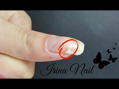 💅 Cum să repari o unghie ruptă | Nail repair | Irina Nail