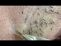 【Plucking facial hair】ずっと見ていられる完成のヒゲ抜き　2020 12 11（鼻下ヒゲ抜き残り全部）【Pull out the beard】