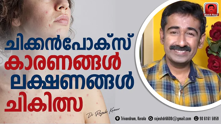 Chickenpox Causes, Symptoms & Treatment - DayDayNews