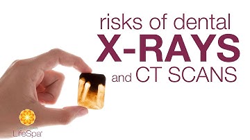 Risks of Dental X-Rays and CT Scans | John Douillard