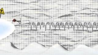 Stickman Ski Racer - Replay screenshot 4