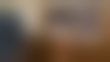 2-Level Spondy treated using State of the Art Endoscopic MIS TLIF