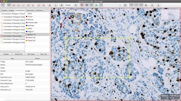 Pixel Classification using QuPath