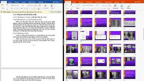 Chẩn đoán hình ảnh | Hệ tiết niệu (phần 4) - Những hình ảnh bất thường của thận