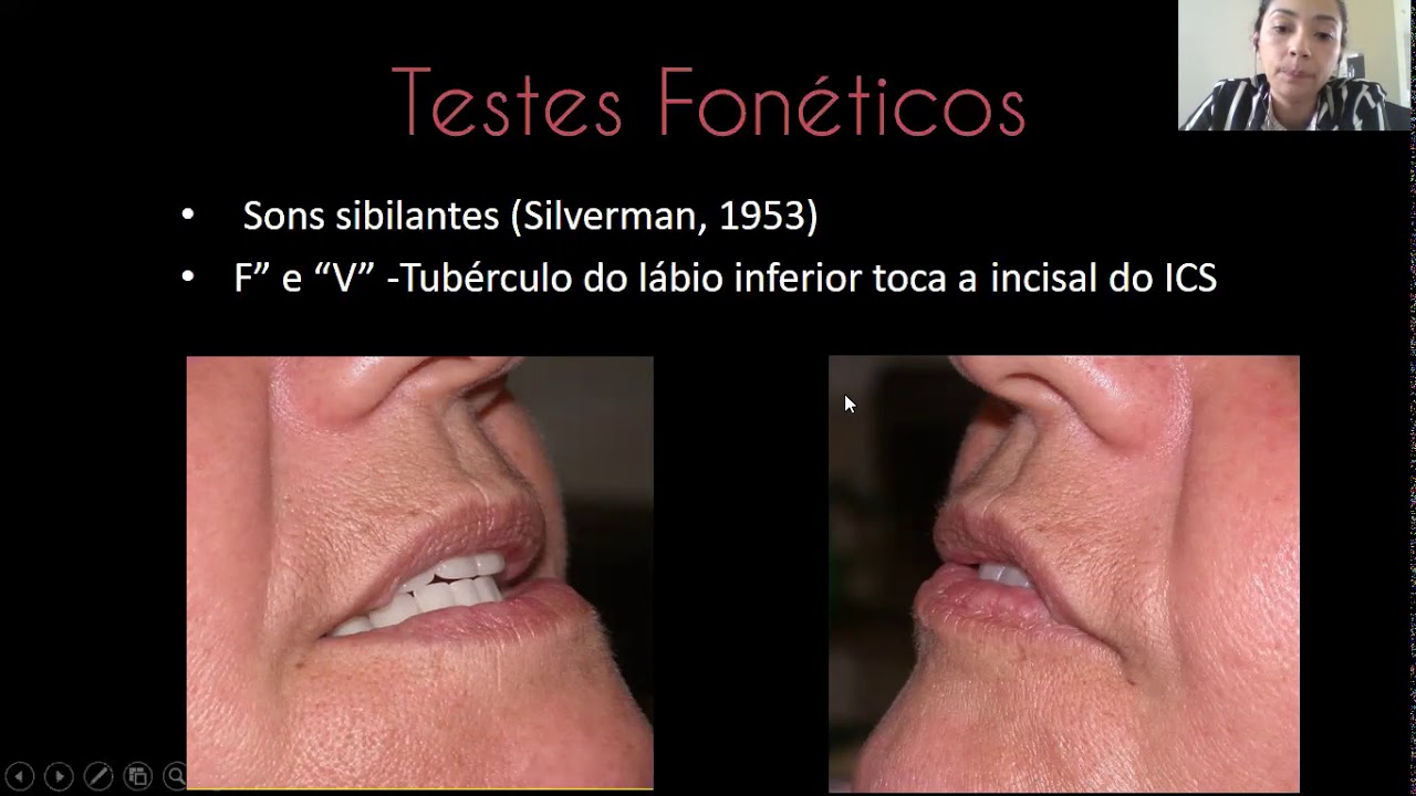 Prova dos dentes e instalação