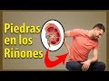 OJO primeros sintomas Que indican que TU RIÑON esta dañado