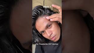 The Hair Routine That Changed My Hairline 💪