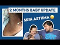 MAY SKIN ASTHMA SI BABY 😢 | 2ND MONTH BABY UPDATE | Preemie Baby Philippines | WeTheTZN  VLOG #131