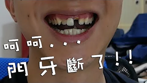 我的門牙斷了!!牙仙子晚上會來嗎XD - 天天要聞