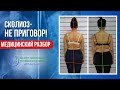 Медицинский разбор «СКОЛИОЗ НЕ ПРИГОВОР»