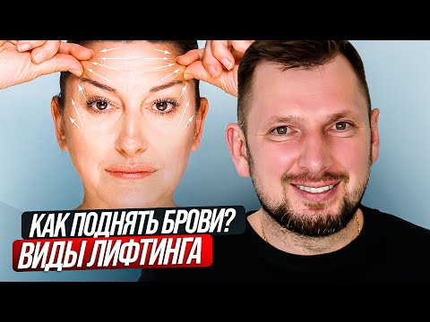 Видео: Что такое подтяжка бровей?