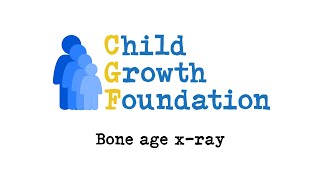Bone age x-ray