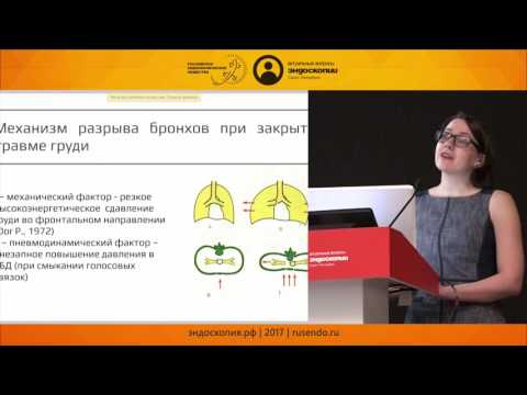 Эндобронхиальное клипирование разрыва бронха при закрытой сочетанной травме груди