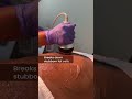 Say goodbye to stubborn fat! Advanced Lipo Laser Therapy – visible weight loss