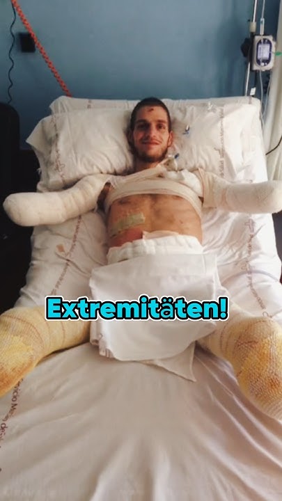 Er verlor seine Arme und Beine ️? - YouTube