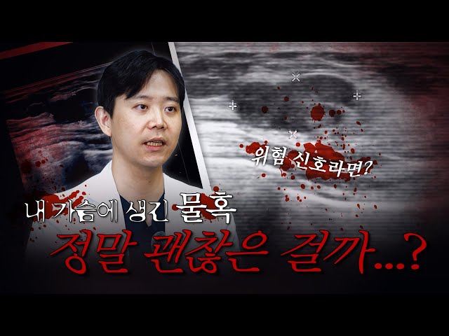 가슴에 '이것' 생겼으면 당장 오세요