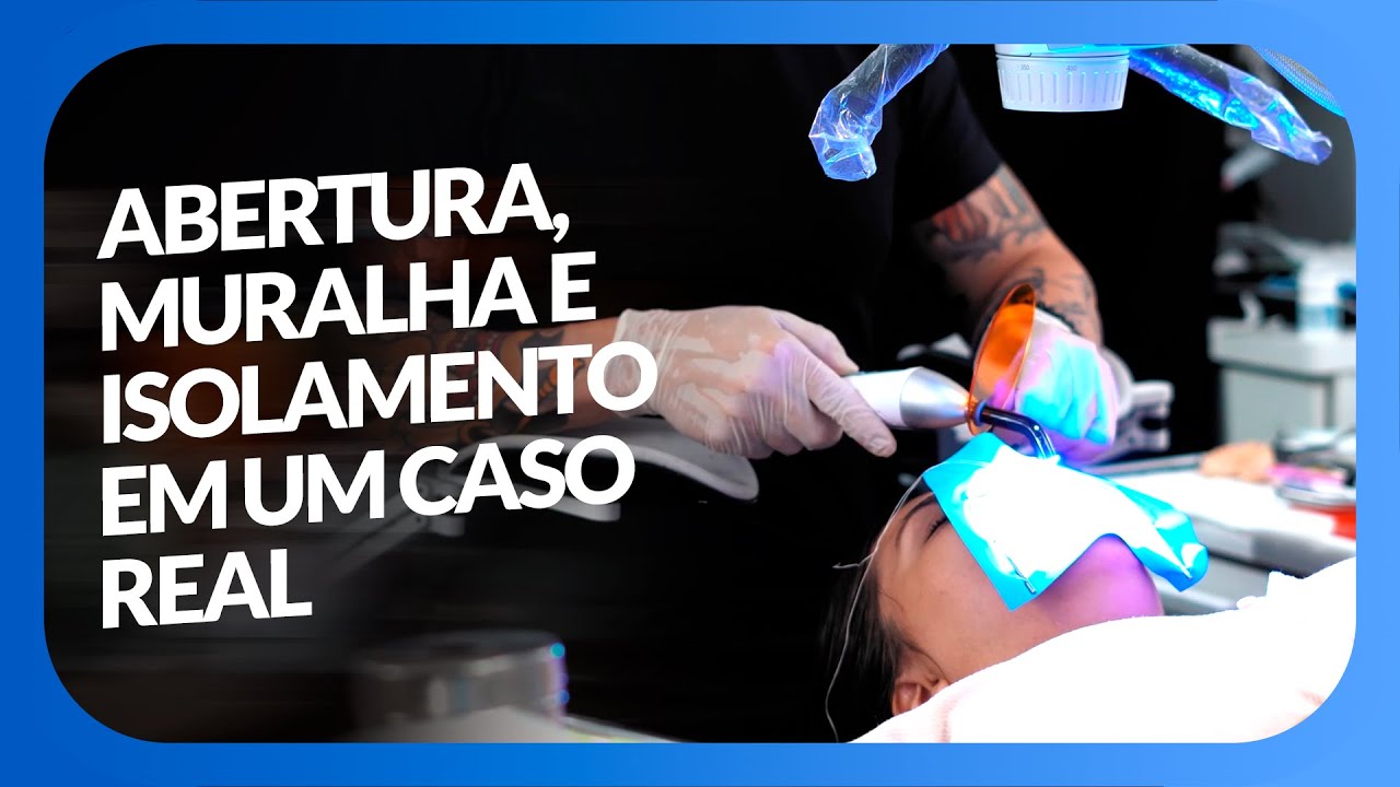 FECHAMENTO DE DIASTEMA COM TÉCNICA DA MURALHA