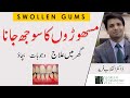      never get gum swelling again   home treatment  urdu  hindi 