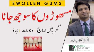مسھوڑوں کا سوجھ جانا | Never Get Gum Swelling Again! | Home Treatment | Urdu | Hindi |