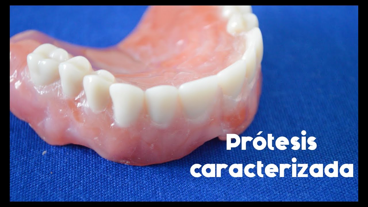 Prótesis caracterizada | Dental Show
