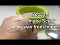 How to make scar wax from home | Sasha-Jade Iceton