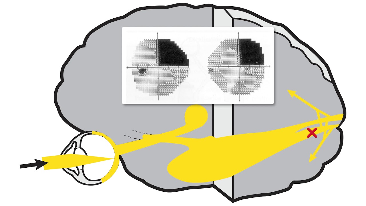 RS Vision Pathway Part 5 - Retrochiasmal Segment