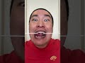 Sagawa1gou funny video 😂😂😂 | SAGAWA Best TikTok 2026 #shorts