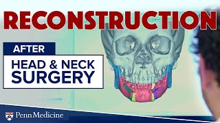 Reconstruction after Head and Neck Surgery | Penn Medicine ENT