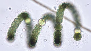 Bluegreen Algae (Cyanobacteria) from Pond to Lab  Pondlife, Episode #2