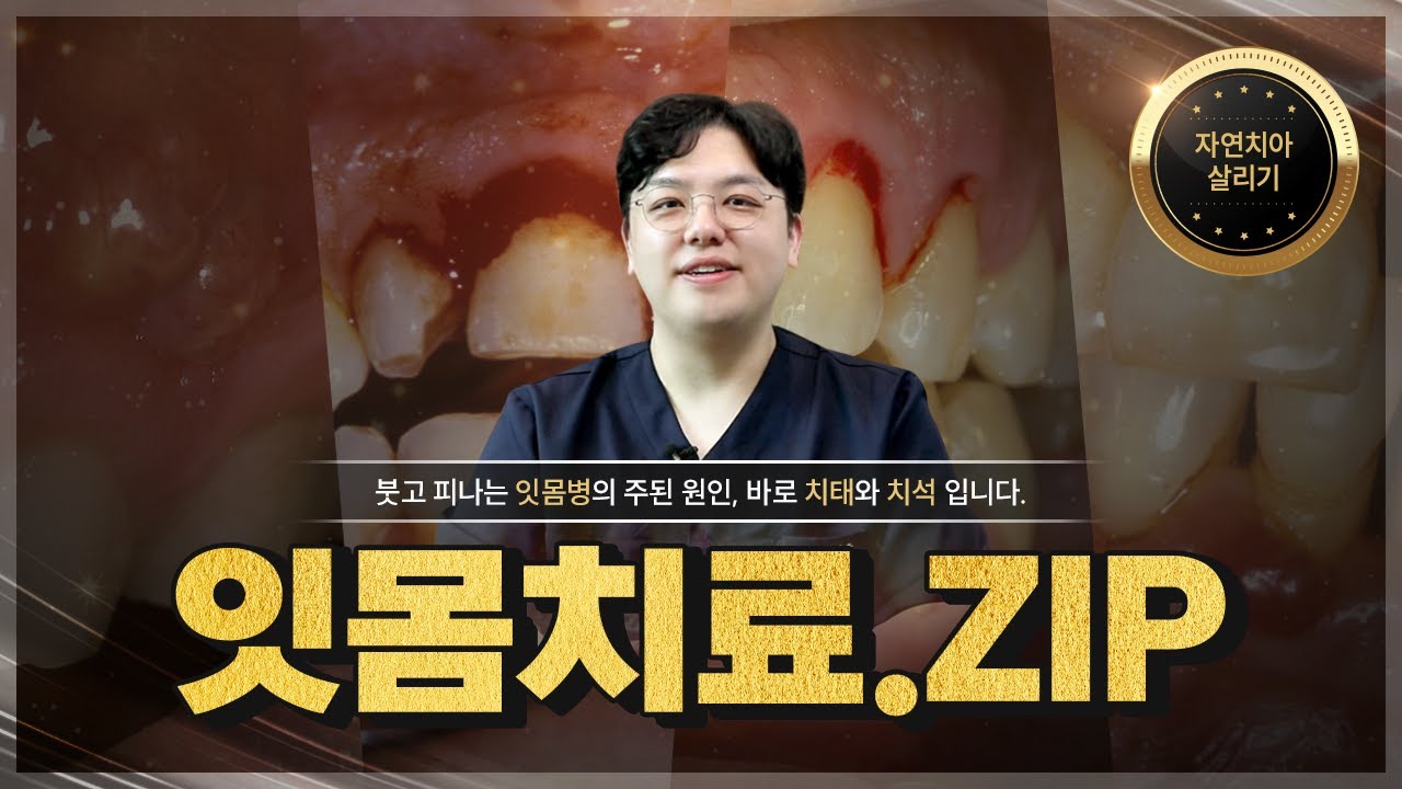 잇몸치료 방법은? 비용은? 통증은? 👍 치카푸가 알려주는 잇몸치료의 모든 것!