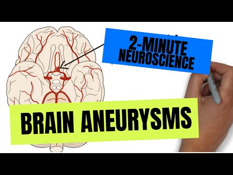 2-मिनट तंत्रिका विज्ञान: मस्तिष्क धमनीविस्फार