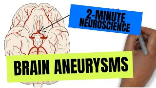 2-Minute Neuroscience: Brain Aneurysms