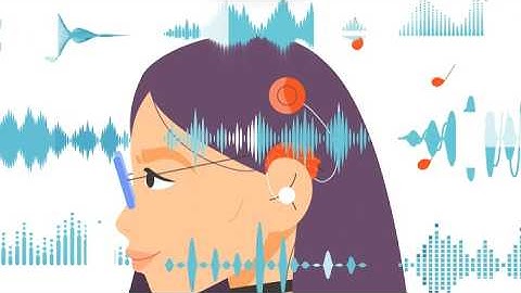 What a cochlear implant sounds like: Research Background and Method