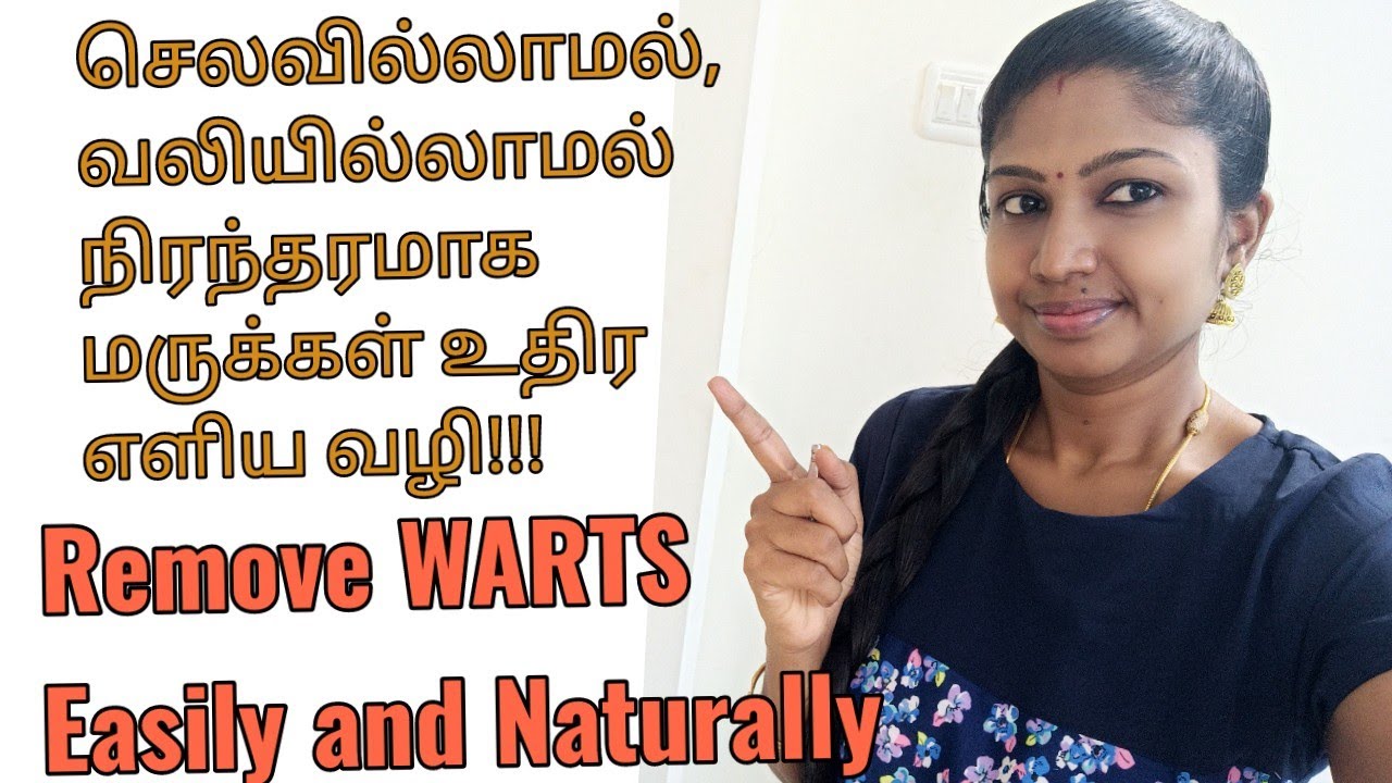 how-to-remove-warts-naturally-at-home-tips-to-remove-wart-in-tamil