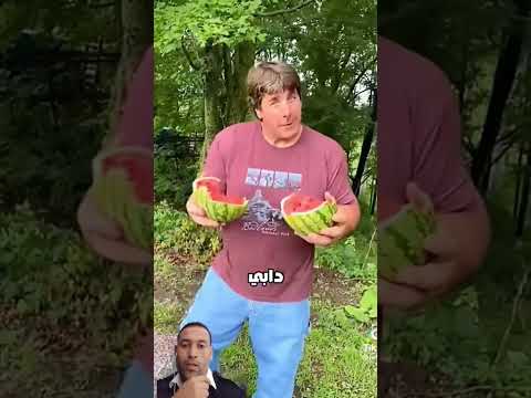 شاهد يمتلك أكبر يدين في العالم