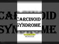Carcinoid Syndrome: Symptoms, Causes, and Treatment #shorts