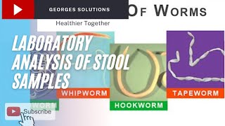 Laboratory Analysis of Stool Samples