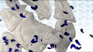 CLEAR CARE MOA video