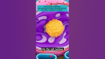 Science behind NFκB activation in HER2+ breast cancer & its link with inflammation & cancer #HER2