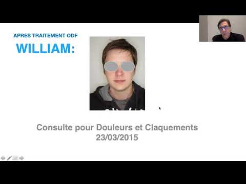 Vidéo: Les Associations Entre Les Facteurs Liés Au Travail Et Les Troubles Temporo-mandibulaires Chez Les Femmes Employées à Plein Temps: Résultats De La Quatrième Enquête Nationale Corée