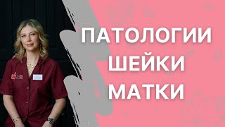 Патологии шейки матки и их взаимосвязь с бесплодием