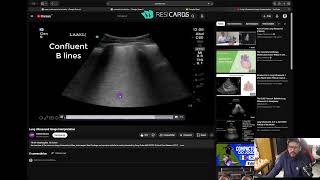 Transmissão da Madrugada com POCUS, Xadrez e ECG.