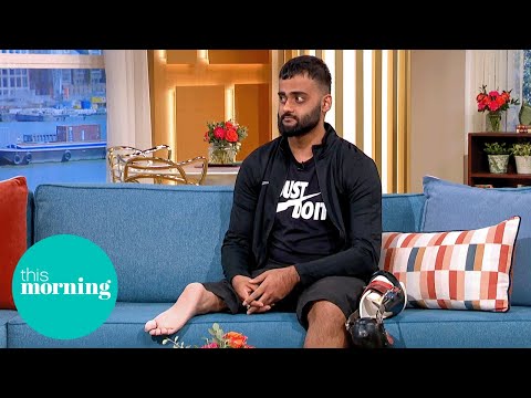 ‘I Had My Leg Amputated and My Foot Sewn On Backwards’ | This Morning