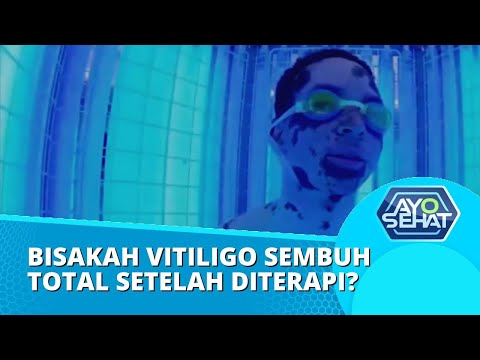 Video: Mengapa vitiligo tidak bisa disembuhkan?