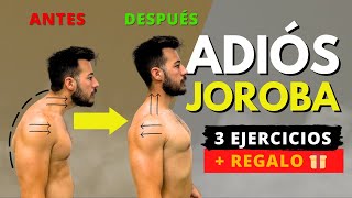ADIÓS a tu JOROBA con los Mejores Ejercicios para tu ESPALDA + REGALO! 🎁