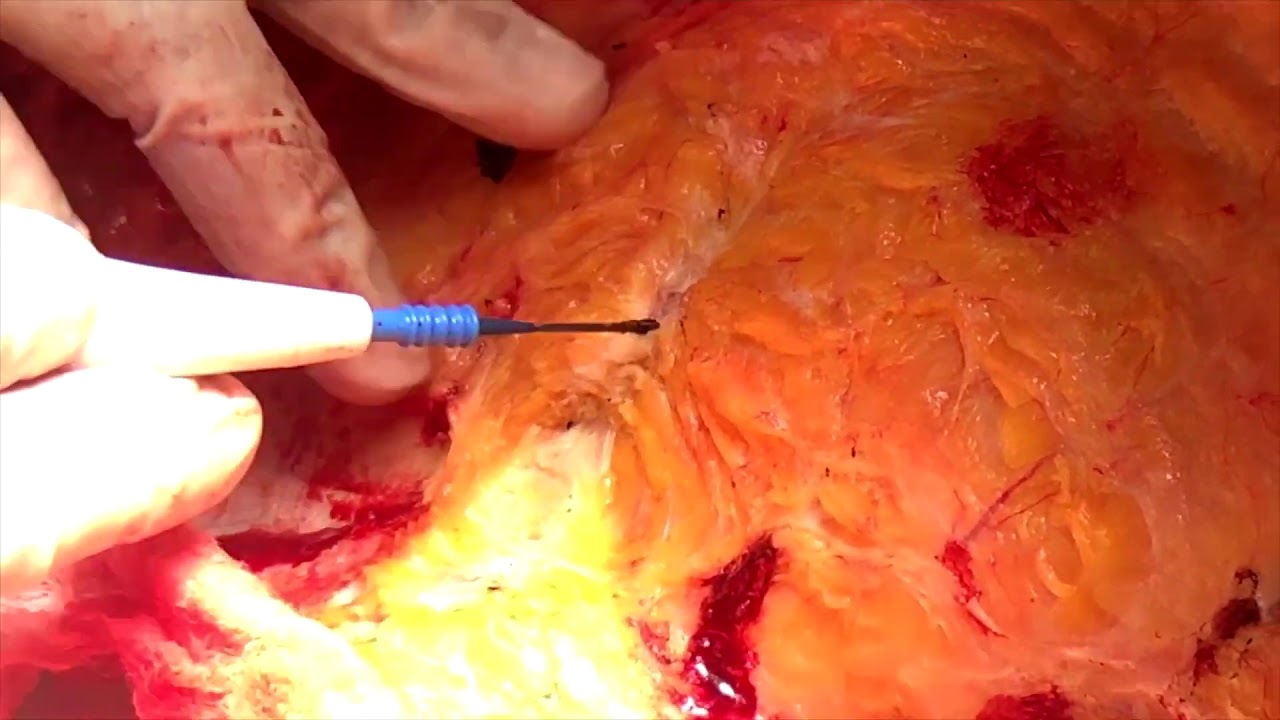 What Does Scar tissue look like on the inside? | North Texas Plastic
