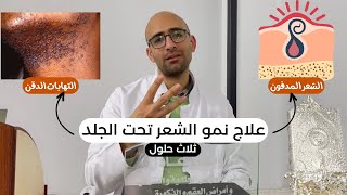 علاج نمو الشعر تحت الجلد - الشعر المدفون