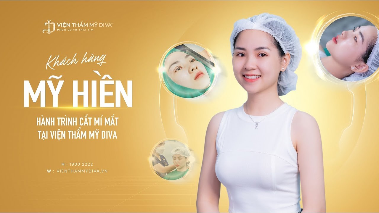 cắt mí mắt đẹp tự nhiên